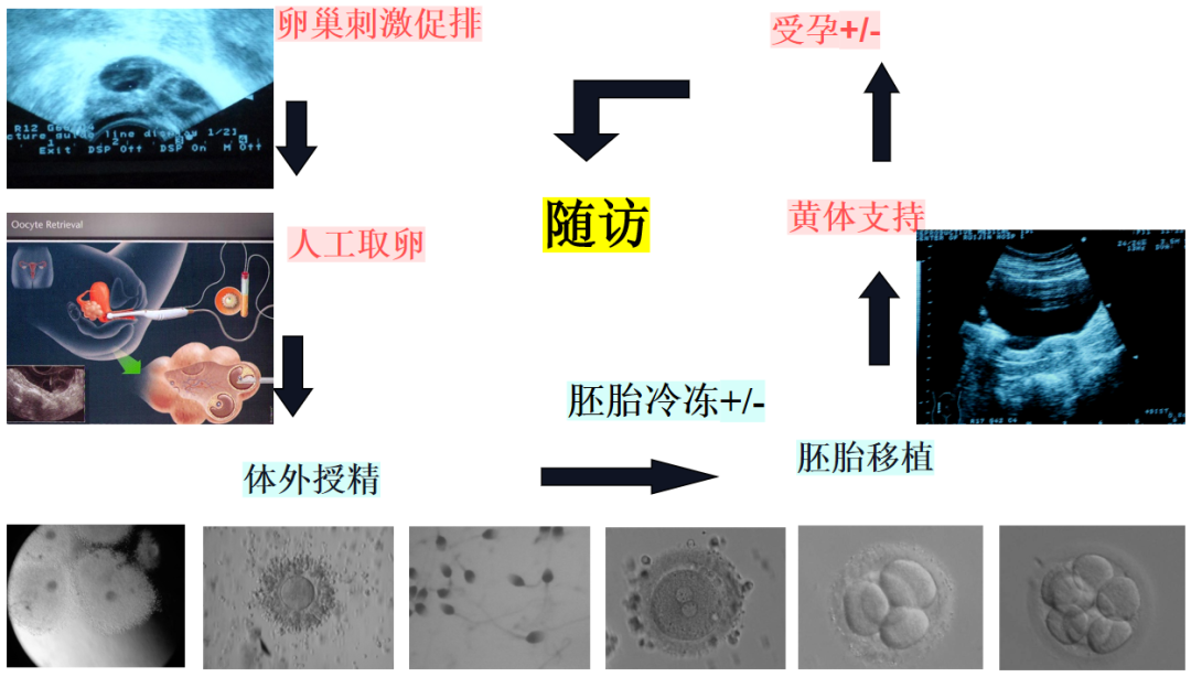 为什么要做试管婴儿？什么情况下要做试管婴儿的？你真的需要做试管婴儿吗?