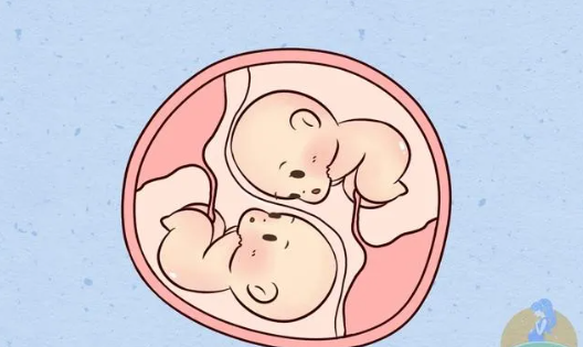 双胞胎试管婴儿成功率有多少，试管婴儿移植双胎好还是单胎好