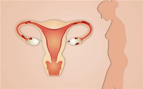 患有子宫内膜异位症怀孕有影响怎么办？