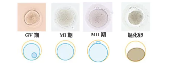 卵子成熟障碍的原因