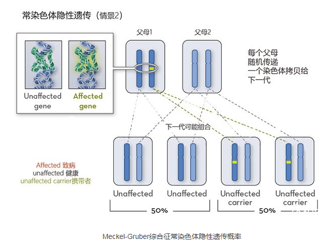 Meckel-Gruber综合征通过PGD避免