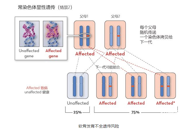 软骨发育不全怎么遗传？能通过3代技术避免吗？